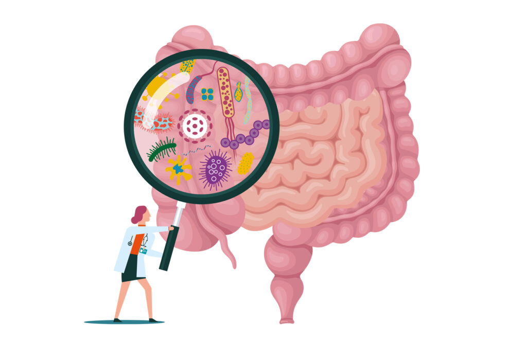 Disbiosis intestinal, Inflamación silenciosa, Microinflamación, Inflamación de bajo grado, Permeabilidad intestinal, Microbiota intestinal
